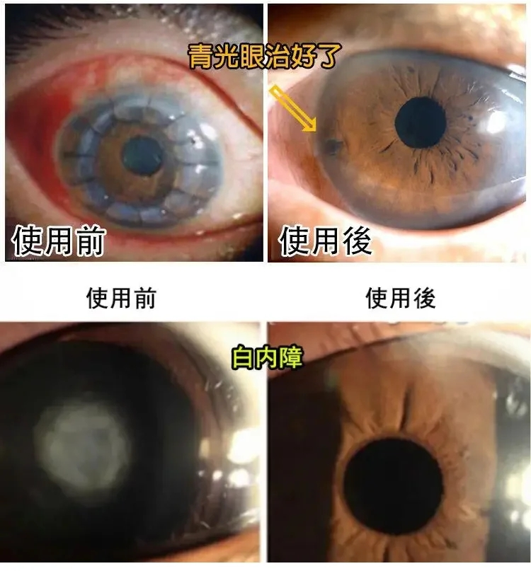 5ceef83bc81a389710a563c3958affe.png