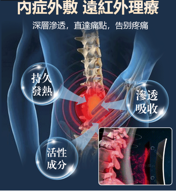✅【專為腰椎問題研發】蒙奧神藥貼！ ✅輕鬆應對關節疼痛與不適，有效治疗腰間盤突出！ ✅腰肌勞損/腰痛酸麻/腰腿疼痛/肩周不適/勁椎不適，哪痛貼哪！