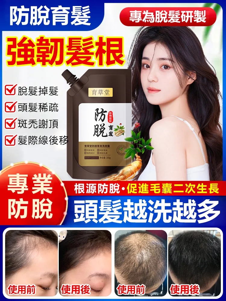 【育草堂防脫育發洗髮露】效果出類拔萃,眾多護髮品中的佼佼者。養髮,護髮,祛除頭皮上的角質,油脂,污垢。